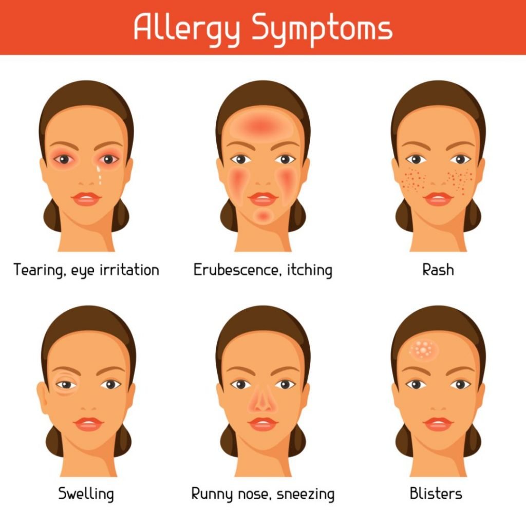 Allergy symptoms