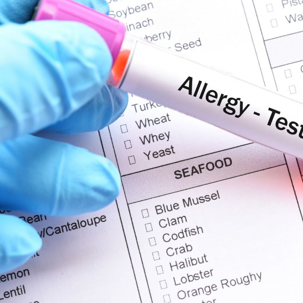 Allergy tests